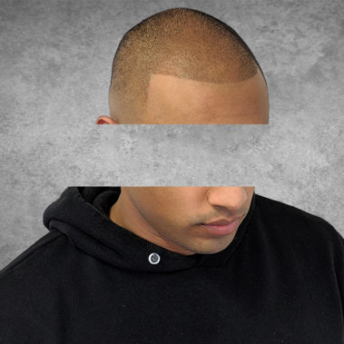 Micropigmentation Gallery Case Studies, Gallery