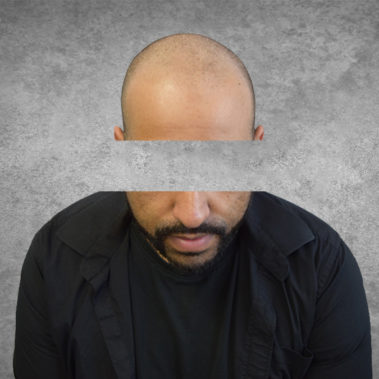 Micropigmentation Gallery Case Studies, Gallery