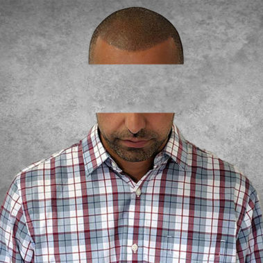 Micropigmentation Gallery Case Studies, Gallery