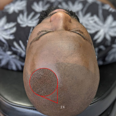 Micropigmentation Gallery Case Studies, Gallery