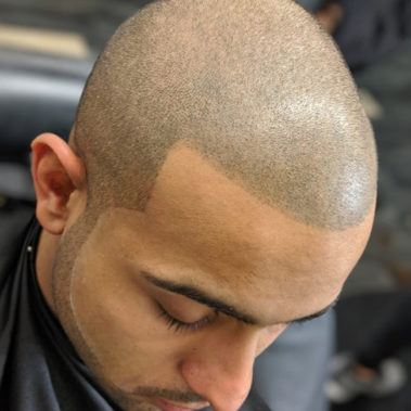 Micropigmentation Gallery Case Studies, Gallery