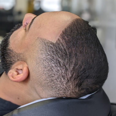 Micropigmentation Gallery Case Studies, Gallery