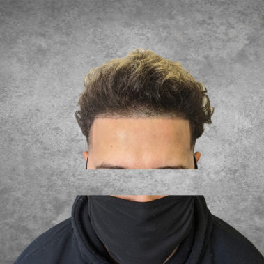 Micropigmentation Gallery Case Studies, Gallery