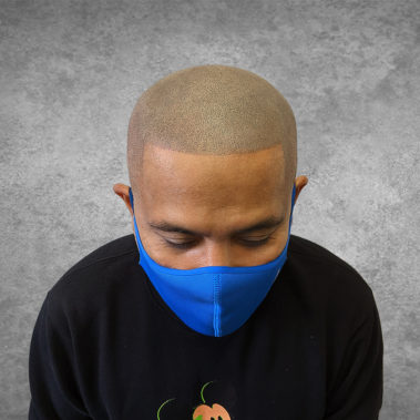 Micropigmentation Gallery Case Studies, Gallery