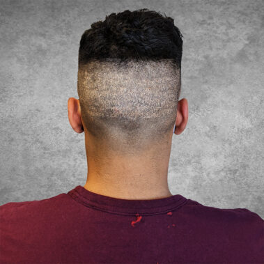 Micropigmentation Gallery Case Studies, Gallery