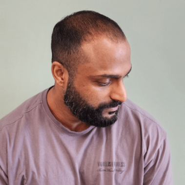 Micropigmentation Gallery Case Studies, Gallery