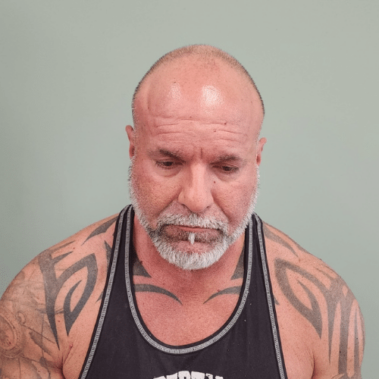 Micropigmentation Gallery Case Studies, Gallery