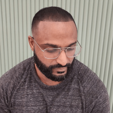 Micropigmentation Gallery Case Studies, Gallery