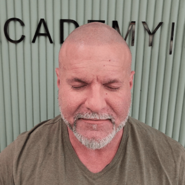 Micropigmentation Gallery Case Studies, Gallery