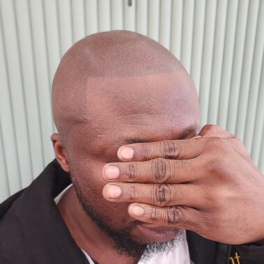 Micropigmentation Gallery Case Studies, Gallery