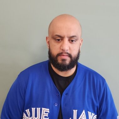 Micropigmentation Gallery Case Studies, Gallery