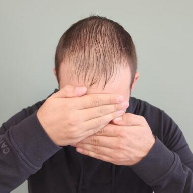 Micropigmentation Gallery Case Studies, Gallery