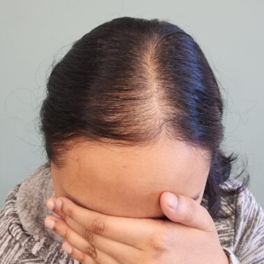 Micropigmentation Gallery Case Studies, Gallery