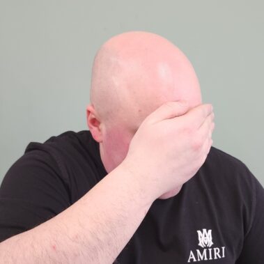 Micropigmentation Gallery Case Studies, Gallery