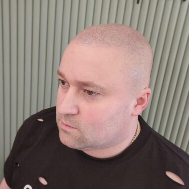 Micropigmentation Gallery Case Studies, Gallery