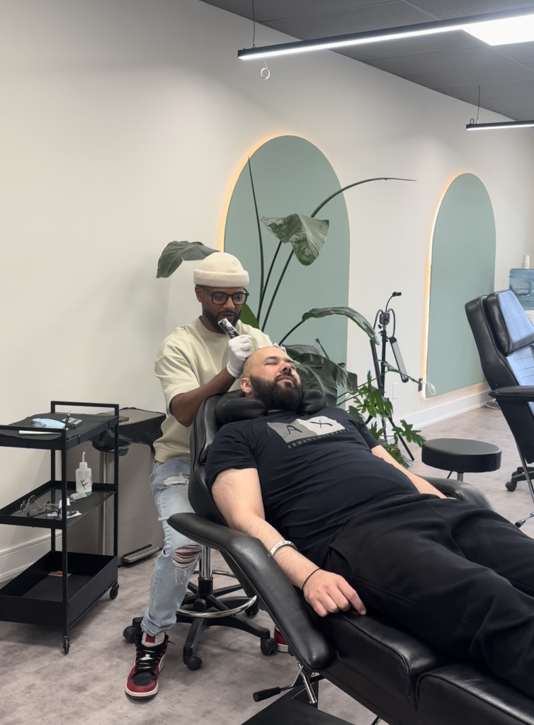 Scalp Micropigmentation, Soft Hairline SMP