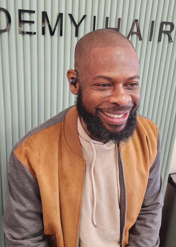 Scalp Micropigmentation, Full Scalp Micropigmentation