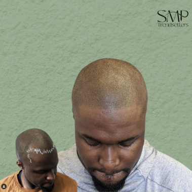 Micropigmentation Gallery Case Studies, Gallery