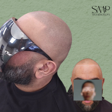 Micropigmentation Gallery Case Studies, Gallery